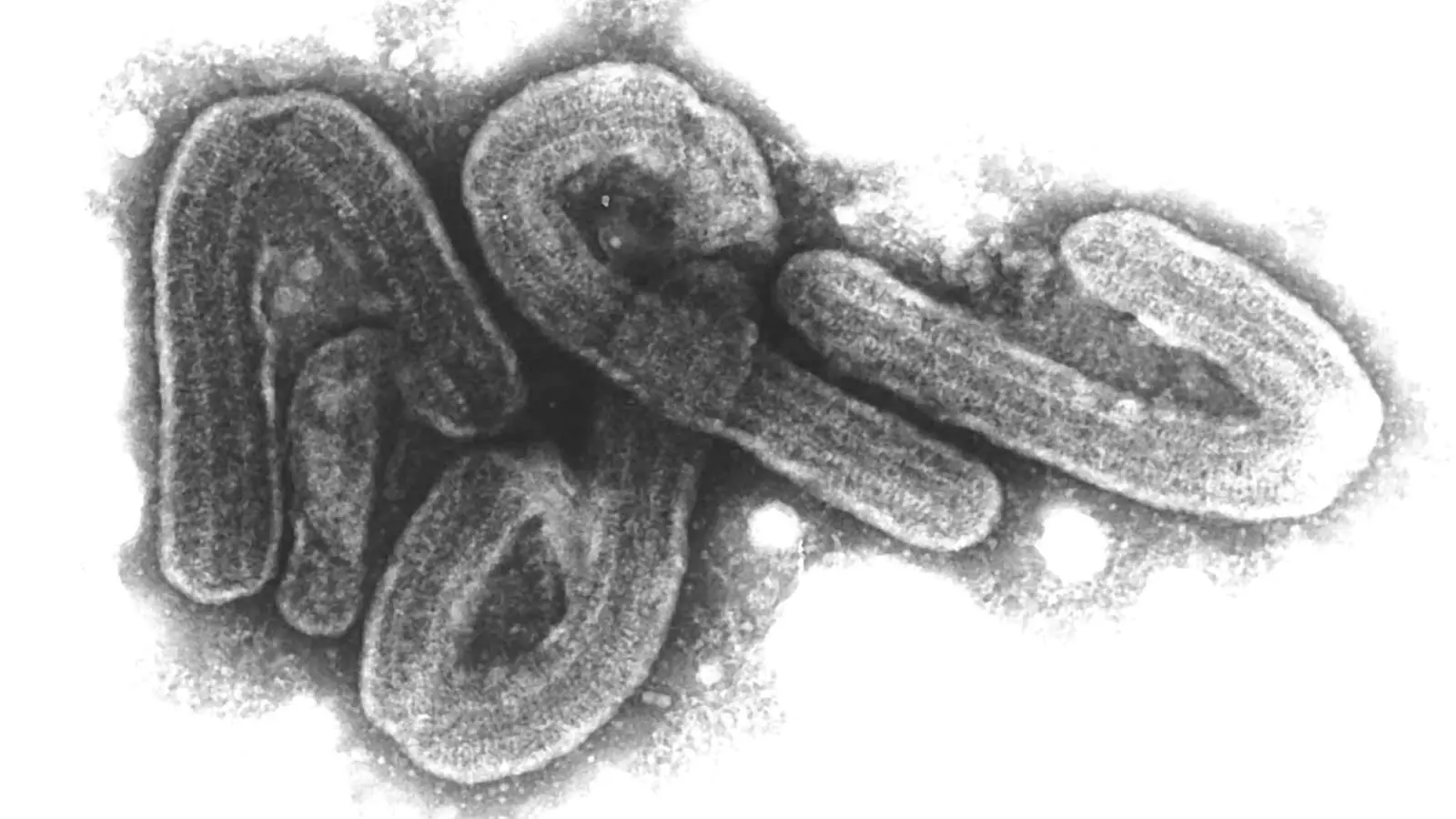 Eine elektronenmikroskopische Aufnahme des Marburg-Virus. (Archivbild) (Foto: Bernhard-Nocht-Institut/dpa)