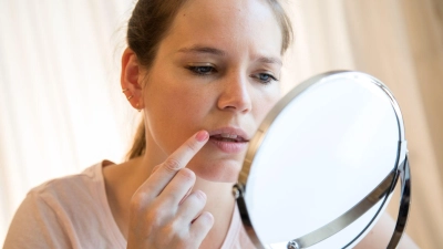 Bildet sich da etwa Herpes? Rezeptfreie Arzneimittel sowie Medizinprodukte versprechen eine schnellere Heilung. Die Stiftung Warentest ist nicht überzeugt. (Foto: Christin Klose/dpa-tmn)