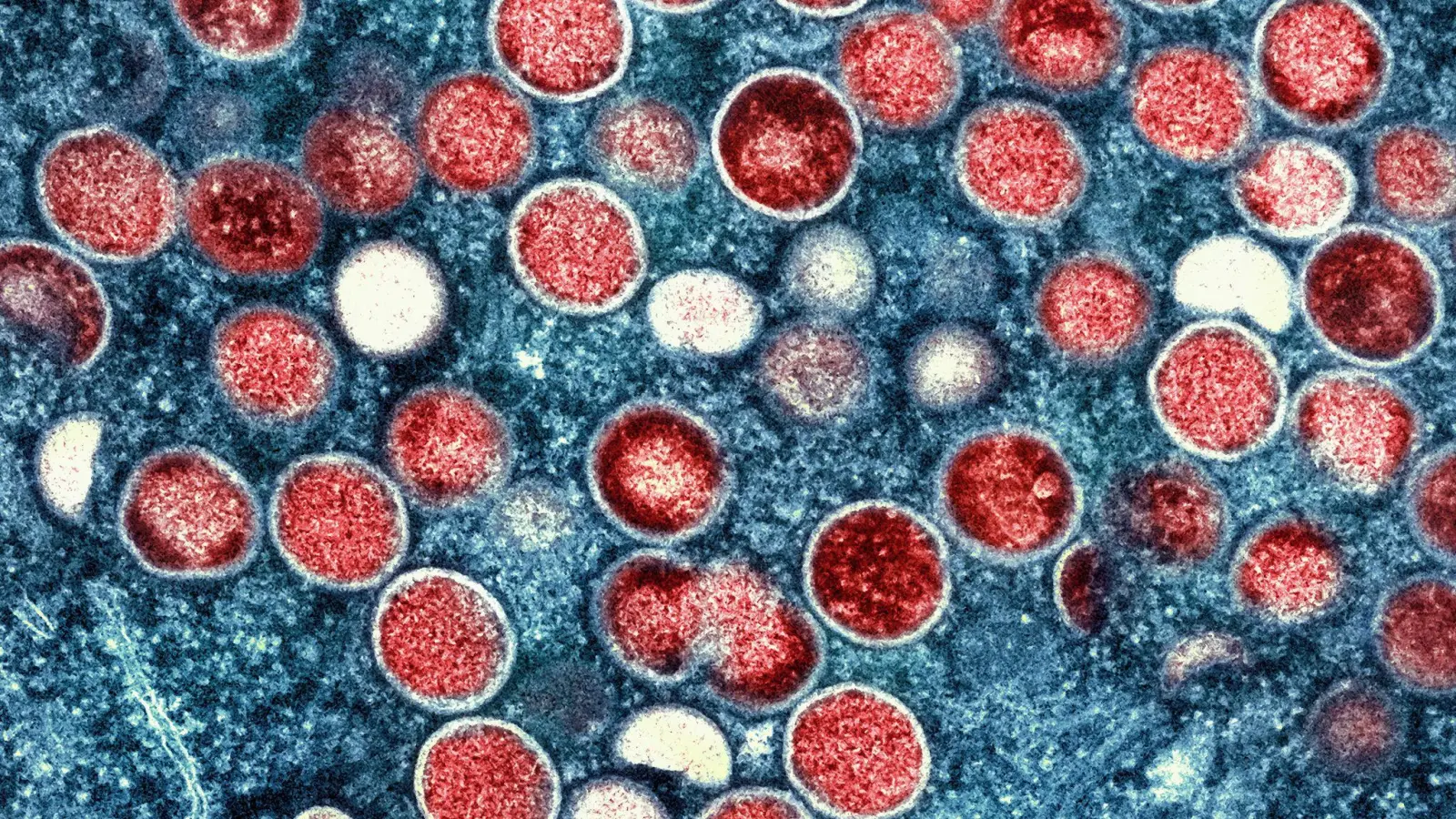 Die Weltgesundheitsorganisation (WHO) hatte im August wegen der zunehmenden Mpox-Verbreitung in Afrika eine „Gesundheitliche Notlage internationaler Reichweite“ erklärt. (Foto: -/National Institute of Allergy and Infectious Diseases/dpa)