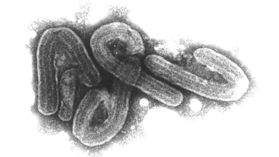 Eine elektronenmikroskopische Aufnahme des Marburg-Virus. (Foto: Bernhard-Nocht-Institut/dpa)